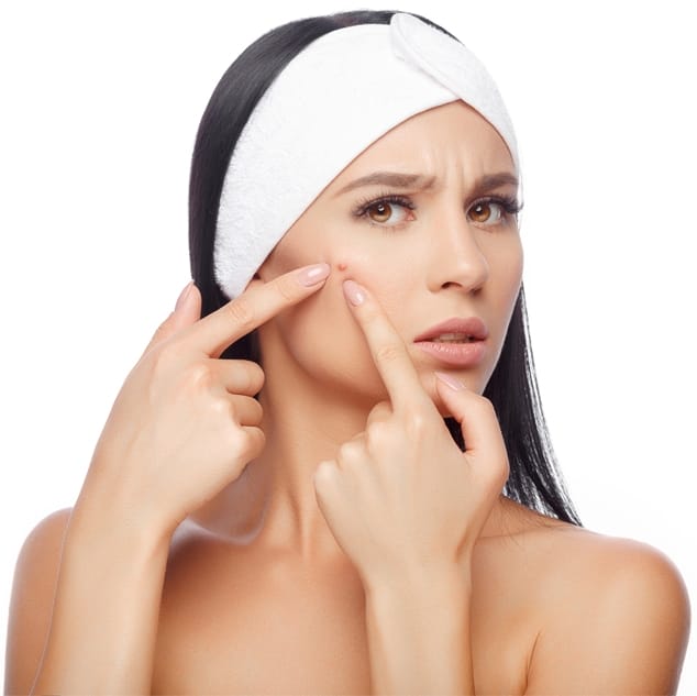 Acne Removal Treatment San Diego, CA
