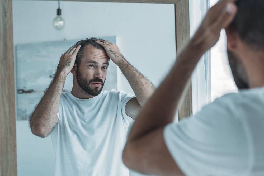 Man examining thinning hair in mirror