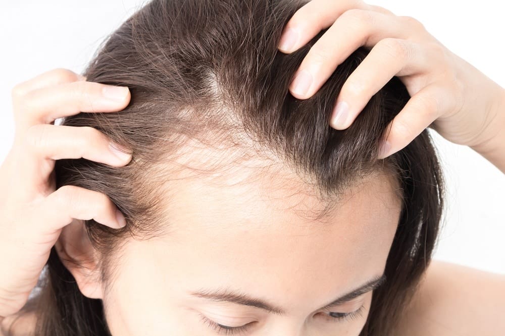 All You Should Know About Rogaine - San Diego Dermatologist All You Should Know About Rogaine - San Diego Dermatologist