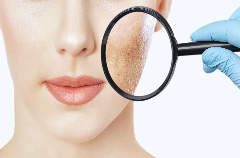 cosmetic dermatology in san diego ca