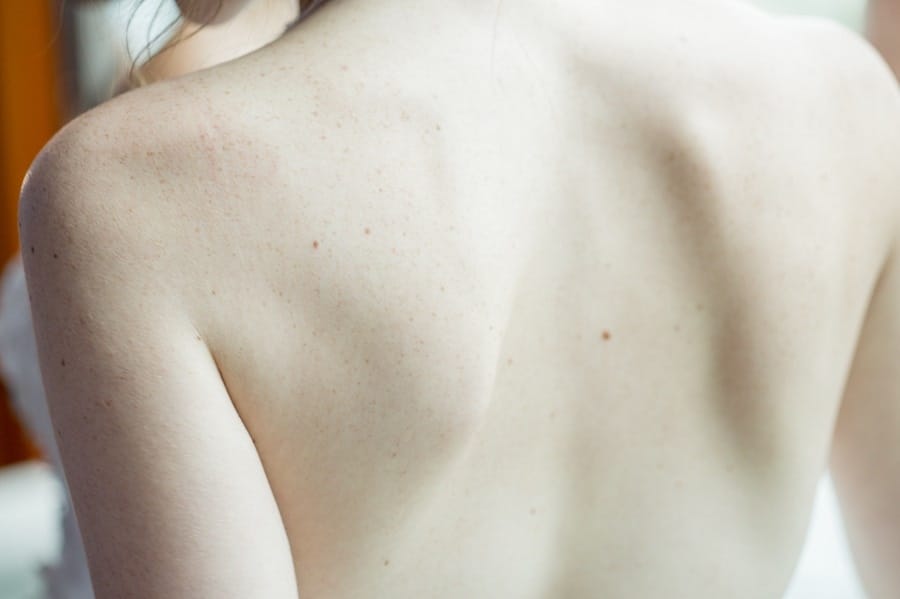 Close Up of Bare Back