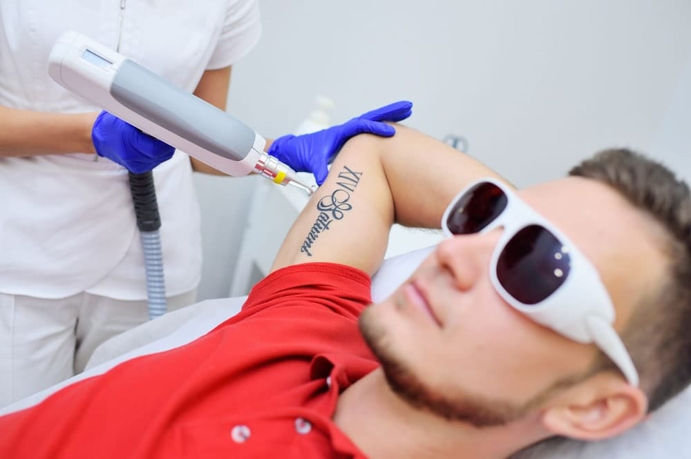 A Guide to Laser Tattoo Removal